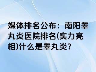 媒体排名公布：南阳睾丸炎医院排名(实力亮相)什么是睾丸炎？